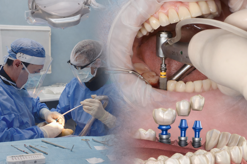 Implants dentaires, Dr Pignard, Auriol 13390