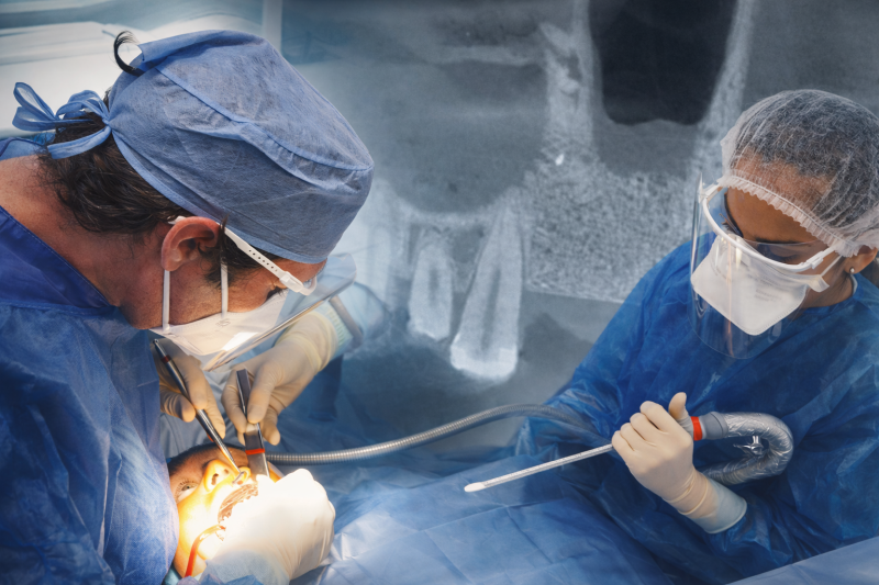 Greffe osseuse de sinus, Dr Pignard, Auriol