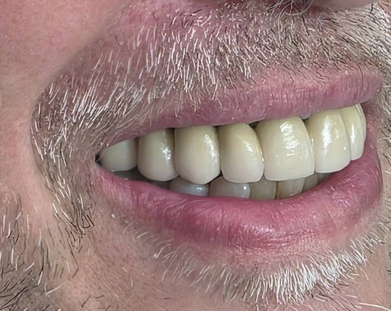 Sourire sans crochet, Dr Pignard, Auriol